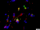 Raw data for publication titled "Bone Marrow Myeloid–Lymphatic Progenitors Expand Tumor Lymphatic Vasculature Through Cell Fusion"