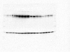 hERG and KvLQT1 immunoblots for expression and surface abundance